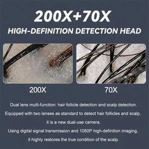 बाल विरोधी लॉस एलसीडी स्क्रीन बाल खोपड़ी और त्वचा विश्लेषक मशीन बाल तेल और नमी विश्लेषण सौंदर्य व्यक्तिगत देखभाल उत्पाद - Product Image 4