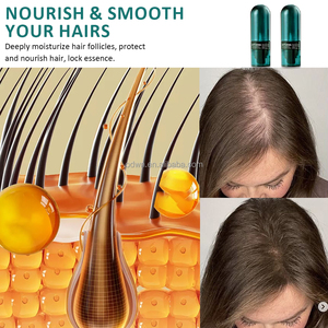 OTVENA <span class=keywords><strong>Meilleur</strong></span> <span class=keywords><strong>sérum</strong></span> en spray pour la croissance des cheveux biologique Réduire la perte de cheveux Favoriser la croissance des cheveux Essence - Product Image 2