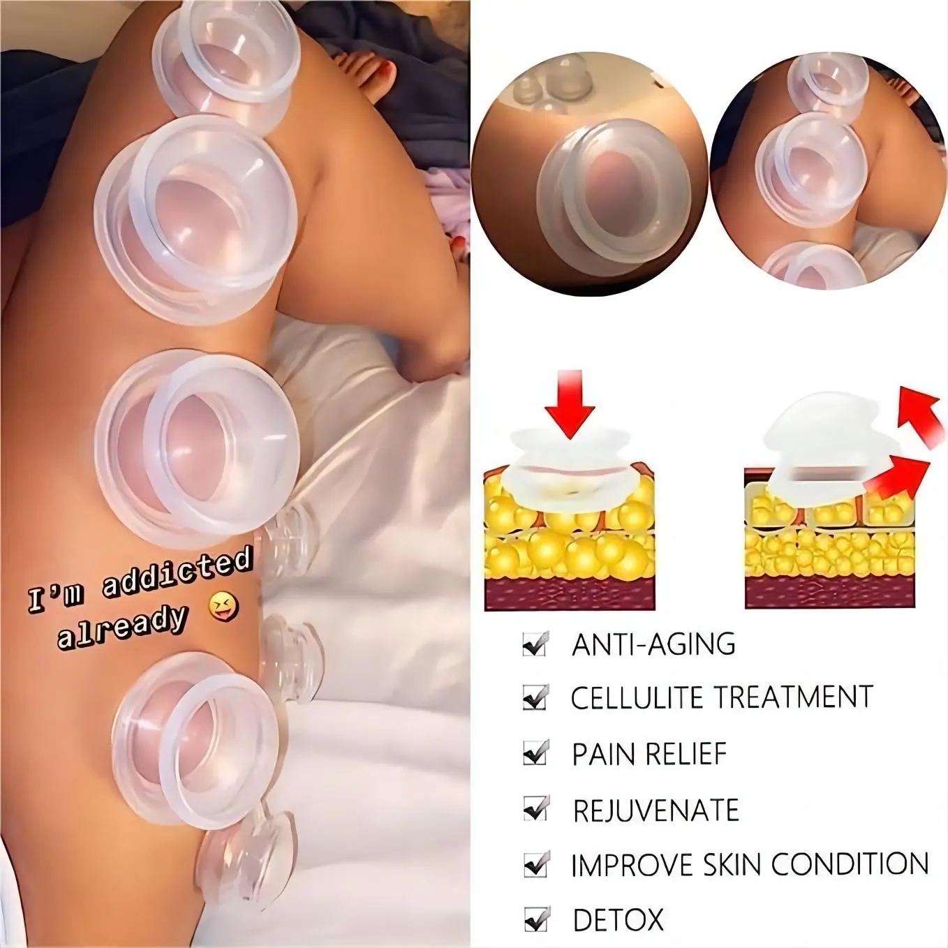 Nieuw Ontwerp Nek En Rug Massager Siliconen Hijama Cups Cupping Therapie Massager Voor Anti Cellulitis