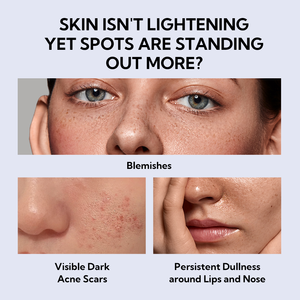 Lanbena Vente en gros Sérum collagène niacinamide à l'acide hyaluronique blanchissant naturel biologique pour la peau - Product Image 4