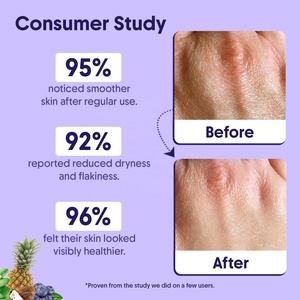 Loción Exfoliante con 10% de Ácido Glicólico + Ácido Láctico, <span class=keywords><strong>Crema</strong></span> Hidratante con Ácido Hialurónico, <span class=keywords><strong>Crema</strong></span> Corporal Exfoliante con AHA - Product Image 5