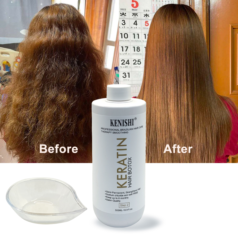 บอต็อกซ์ผม