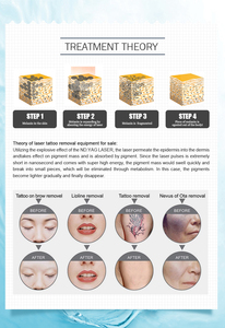 Máquina Portátil de Eliminación de Tatuajes con Láser de Picosegundos, Eliminación de Pigmentos, Peeling de Carbón, Blanqueamiento, Cepillo de Limpieza Facial - Product Image 3