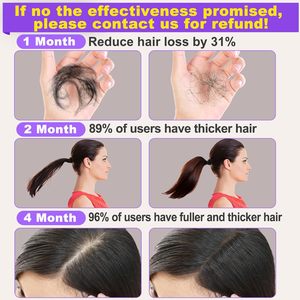 Minyak Rosemary Serum penumbuh rambut, untuk perawatan rambut tumbuh ke dalam tebal rusak kering mengurangi rambut rontok minyak kulit kepala - Product Image 5