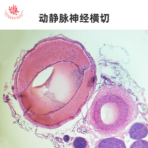 Microestructura típica de las pruebas de microscopio del sistema circulatorio, que incluyen venas grandes, arterias grandes y vasos renales después de la coloración HE. - Product Image 3