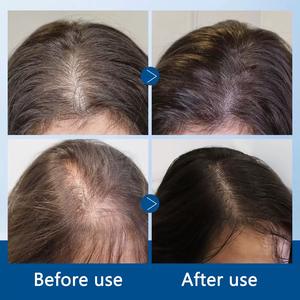 Sérum Natural Anti-Queda de Cabelo Orgânico de 25ML com Marca Privada, Fortalecedor e Nutritivo, Óleo de Crescimento Capilar com Ginseng - Product Image 4