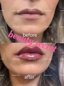 Huile Repulpante Lèvres Effet Picotant Instant Gloss Extrême Stylo Repulpant Lèvres au Collagène, Squalane et FPS 20 - Product Image 4