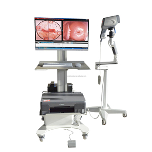 Digital medis pemeriksaan glikologic kamera HD Video Vagina kamera untuk ginekologi Vagina endoskopi - Product Image 4