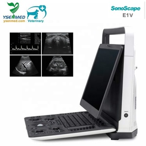 Ecógrafo Veterinario E1V 3D/2D Blanco y Negro Portátil con Pantalla de 15.6 Pulgadas, Transductor Lineal Endocavitario L741V USB E1V Sonoscap - Product Image 5