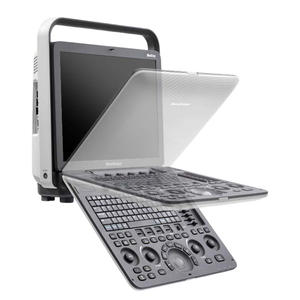 Système d'échographie vétérinaire professionnel Sonoscape S8 ExpV pour des soins hospitaliers complets aux animaux - Product Image 5