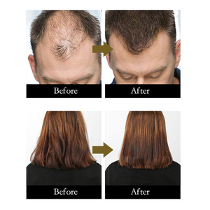 Après-shampoing <span class=keywords><strong>Bio</strong></span> à base de kératine, 500 Ml, après-shampoing organique pour cheveux bouclés et abîmés - Product Image 4