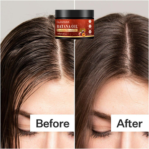Aceite Esencial <span class=keywords><strong>de</strong></span> Batana para <span class=keywords><strong>el</strong></span> Cabello, Marca Privada OEM, Aceite <span class=keywords><strong>de</strong></span> Batana Crudo Hondureño Anticaída para <span class=keywords><strong>el</strong></span> Crecimiento del Cabello - Product Image 2