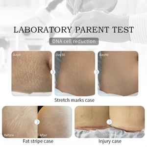 Crème PDRN Efficace pour l'Élimination des Cicatrices, des Boutons d'Acné et des Vergetures, Crème Lissante et Raffermissante Anti-Vergetures, Crème Réparatrice des Cicatrices - Product Image 4