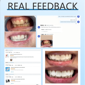 Kit de blanqueamiento dental recargable inalámbrico para uso doméstico barato, 32 luces LED azules y rojas con tiras blanqueadoras, sistema de blanqueamiento dental - Product Image 5