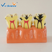 Modelo de Descomposición de Caries Dentales con Aumento 4X, Modelo Desmontable de la Estructura Interna del Diente Deciduado, CE/ISO/ROHS/CNAS