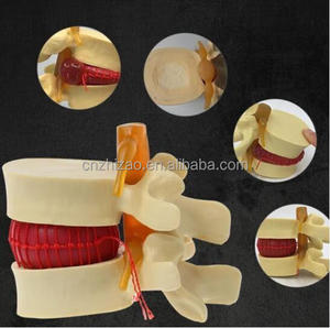 Modèle anatomique éducatif de colonne vertébrale lombaire en PVC pour la maladie des disques intervertébraux humains - Product Image 5