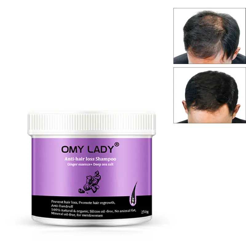 OMYLADY champú y acondicionador de tratamiento para la pérdida de cabello tónico queratina Crema para el cabello