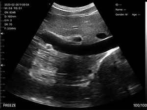 Usb Convexe Ultrasone <span class=keywords><strong>Transducer</strong></span> Draadloze Convexe Array Echografie Sonde Voor Ob/Gyn Long Urologie Toepassing - Product Image 5