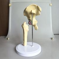 Modèle d'articulation de la hanche avec prothèse artificielle - Composants en PVC et métal ABS pour l'enseignement orthopédique