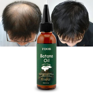 Huile de Batana pour la croissance des cheveux, <span class=keywords><strong>essence</strong></span> pour les soins capillaires, huile essentielle pour l'éclat des cheveux et de la peau, huile de Batana du Honduras 60ml - Product Image 4