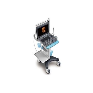 Échographe Doppler Couleur Portable SonoScape S9 Pro avec Batterie Intégrée pour Hôpital - Product Image 4