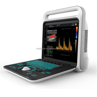 Máquina de ultrasonido Doppler cardíaco de gran oferta con sonda de matriz en fase para uso cardíaco