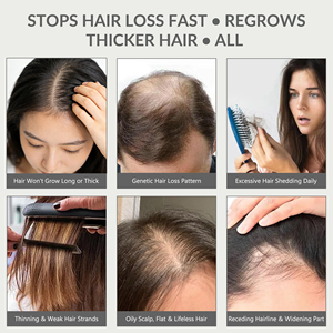 <span class=keywords><strong>Shampoo</strong></span> per la <span class=keywords><strong>Crescita</strong></span> dei <span class=keywords><strong>Capelli</strong></span> con Caffeina e Niacinamide, Senza Parabeni, Anti-Caduta e Nutriente per il Cuoio Capelluto - Product Image 2