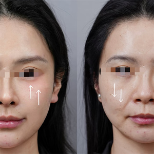 G New Microcurrent Ngón Tay Vàng Hấp Lực Kim Cương Ngón Tay Mặt Nâng Và Làm Săn chắc Chăm Sóc Sức Khỏe Vẻ Đẹp Máy - Product Image 4