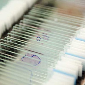 Nhãn Trượt Truyền Nhiệt Chịu Nhiệt Xylene Để Xử Lý Mô Thủ Công - Product Image 5