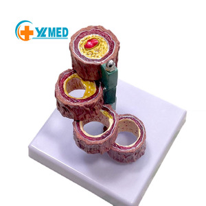 Y tế khoa học con người mạch máu giải phẫu mô hình Organ mạch máu tiến hóa với xơ cứng cho Giải Phẫu nghiên cứu - Product Image 1