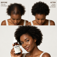 Serum Perawatan Pertumbuhan Rambut Alami Organik Harga Grosir Minyak Rosemary untuk Pertumbuhan Rambut Manfaat Anti-Ketombe