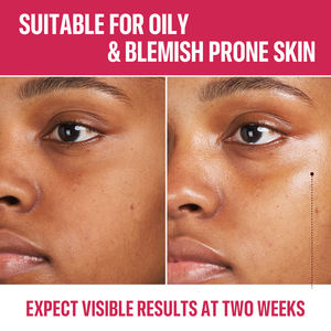 Kit de Soins Éclaircissants et Anti-Âge Marque Blanche à la Vitamine C pour Peaux Noires - Sérum et <span class=keywords><strong>Crème</strong></span> Visage pour Femmes - Product Image 5