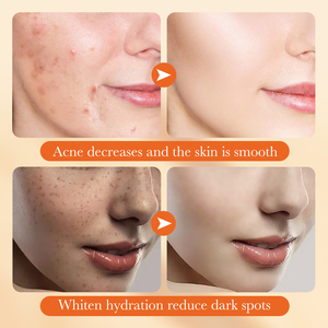 Marque privée SADOER <span class=keywords><strong>Avoine</strong></span> Amino Acid Soft Soothing Essence Milk Hydrate régénère et nourrit la peau Produits de soins du <span class=keywords><strong>visage</strong></span> - Product Image 4