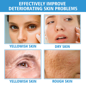 15% <b>Niacinamide</b> Face <b>Serum</b> Even Skin Tone Brightening Hydrating Anti Aging Facial Skincare for Women - Product Image 5