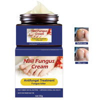 Crème à ongles anti-champignons, ml, pour les ongles et les doigts, réparation de la décoloration, également pour les ongles craquelés