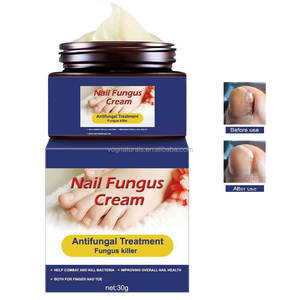 Anti hongos <span class=keywords><strong>uñas</strong></span> crema mata hongos <span class=keywords><strong>en</strong></span> <span class=keywords><strong>las</strong></span> <span class=keywords><strong>uñas</strong></span> de los pies y <span class=keywords><strong>uñas</strong></span> reparaciones decoloración frágil y <span class=keywords><strong>las</strong></span> <span class=keywords><strong>uñas</strong></span> rotas - Product Image 3