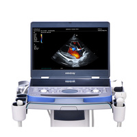 Équipement vétérinaire portable Mindray Vetus 7, système de diagnostic ultrasonore vétérinaire entièrement numérique