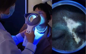 Lámpara de Wood KN-9000B CE, Precio de Fábrica, Analizador Facial de Piel, Lámpara Médica para Análisis de Piel y Detección de Infecciones Fúngicas Veterinarias - Product Image 3