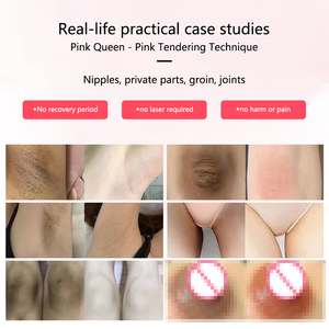 Parte privata <span class=keywords><strong>crema</strong></span> sbiancante per via vaginale essenza capezzolo Areola labbra sbiancamento per la candeggina anale Color rosa <span class=keywords><strong>crema</strong></span> - Product Image 5