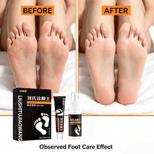 Set <span class=keywords><strong>para</strong></span> el Cuidado <span class=keywords><strong>de</strong></span> los Pies Directo <span class=keywords><strong>de</strong></span> Fábrica <span class=keywords><strong>para</strong></span> el Olor, Picazón, Sudoración y Salud <span class=keywords><strong>de</strong></span> las Uñas, Disponible al por Mayor <span class=keywords><strong>para</strong></span> el Cuidado Diario <span class=keywords><strong>de</strong></span> los Pies - Product Image 3