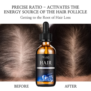Esencia capilar avanzada con biotina Melao de rápida absorción, ligera como una pluma, para hombres, contra la caída del cabello y el cabello fino, sérum para el cuidado del cuero cabelludo. - Product Image 1