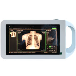 Портативный Электрический цифровой рентгеновский аппарат, уникальное программное обеспечение DROC и беспроводной Wi-Fi, изготовлен из прочного металла - Product Image 1