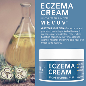 Crema para Eczema y Psoriasis de Marca Privada con Glicerina para Hidratar, Reducir el Enrojecimiento, Efectos <span class=keywords><strong>Antiinflamatorios</strong></span> y Nutritivos - Product Image 4