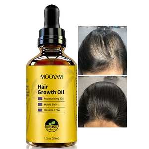 น้ำมันปลูกผมสำหรับผู้หญิงน้ำมันปลูกผมออร์แกนิกสำหรับผมร่วงฉลากส่วนตัวกำหนดโลโก้ได้เอง - Product Image 6