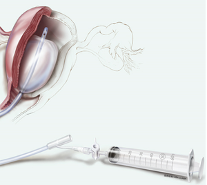 Repair <b>Service</b> and Supply Impact <b>Testing</b> Machine J-SOS-100500 Electronic 3-Year Warranty - Product Image 1