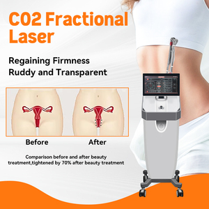 Máquina de Depilación Láser 808/755/1064, Rejuvenecimiento de la Piel, Tensado Vaginal con CO2, Eliminación de Tatuajes, Máquina de Belleza - Product Image 2