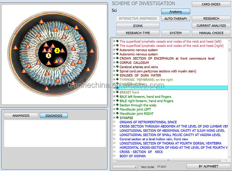 Hot selling 12d aura nls health analyzer with factory price