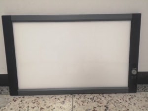 Led <span class=keywords><strong>X</strong></span> <span class=keywords><strong>Ray</strong></span> <span class=keywords><strong>Viewer</strong></span> Tiêu Cực Y Tế <span class=keywords><strong>X</strong></span>-<span class=keywords><strong>Ray</strong></span> <span class=keywords><strong>X</strong></span>-<span class=keywords><strong>Ray</strong></span> Films Tiêu Cực Giá - Product Image 2