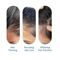 Formula Herbal Organik Ampuh untuk Mempromosikan dan Merangsang Pertumbuhan Rambut Desain Roller Serum Pertumbuhan Rambut Rosemary