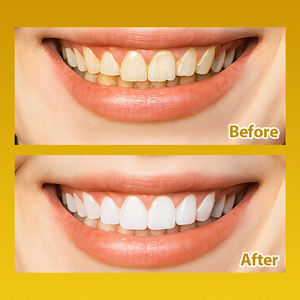 Ensemble de <span class=keywords><strong>dentifrice</strong></span> et de brosse à dents à l'enzyme de citron biologique personnalisé Blanchissant et sans fluor pour les dents sensibles Utilisation à domicile OEM/ODM - Product Image 6